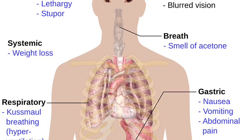 呼吸道（图片：pixabay）