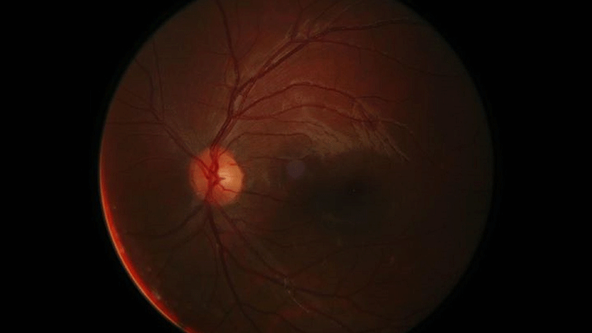 Fundus (Image: pixabay)