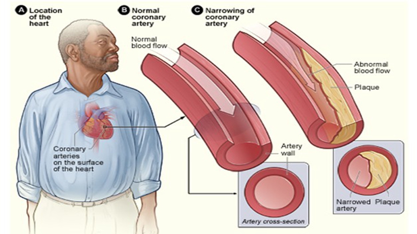 Cardiovascular (Image: Wikimedia)