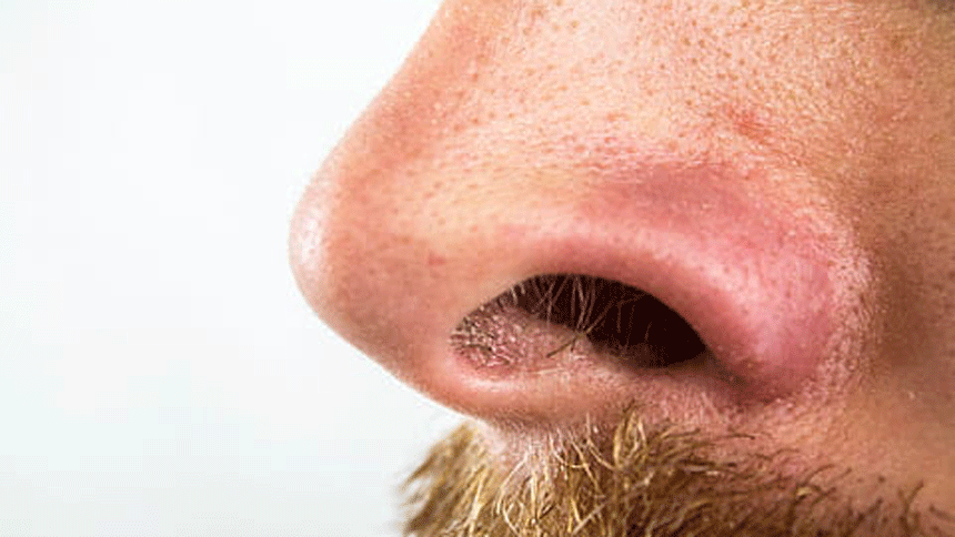 鼻毛为什么会蹿出来 鼻毛旺盛是在暗示什么 老中医告诉你真相 澳洲新闻网