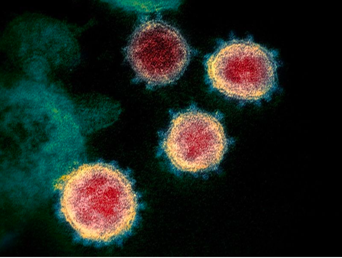 图为美国国家过敏与传染病研究院发布的中共病毒影像。