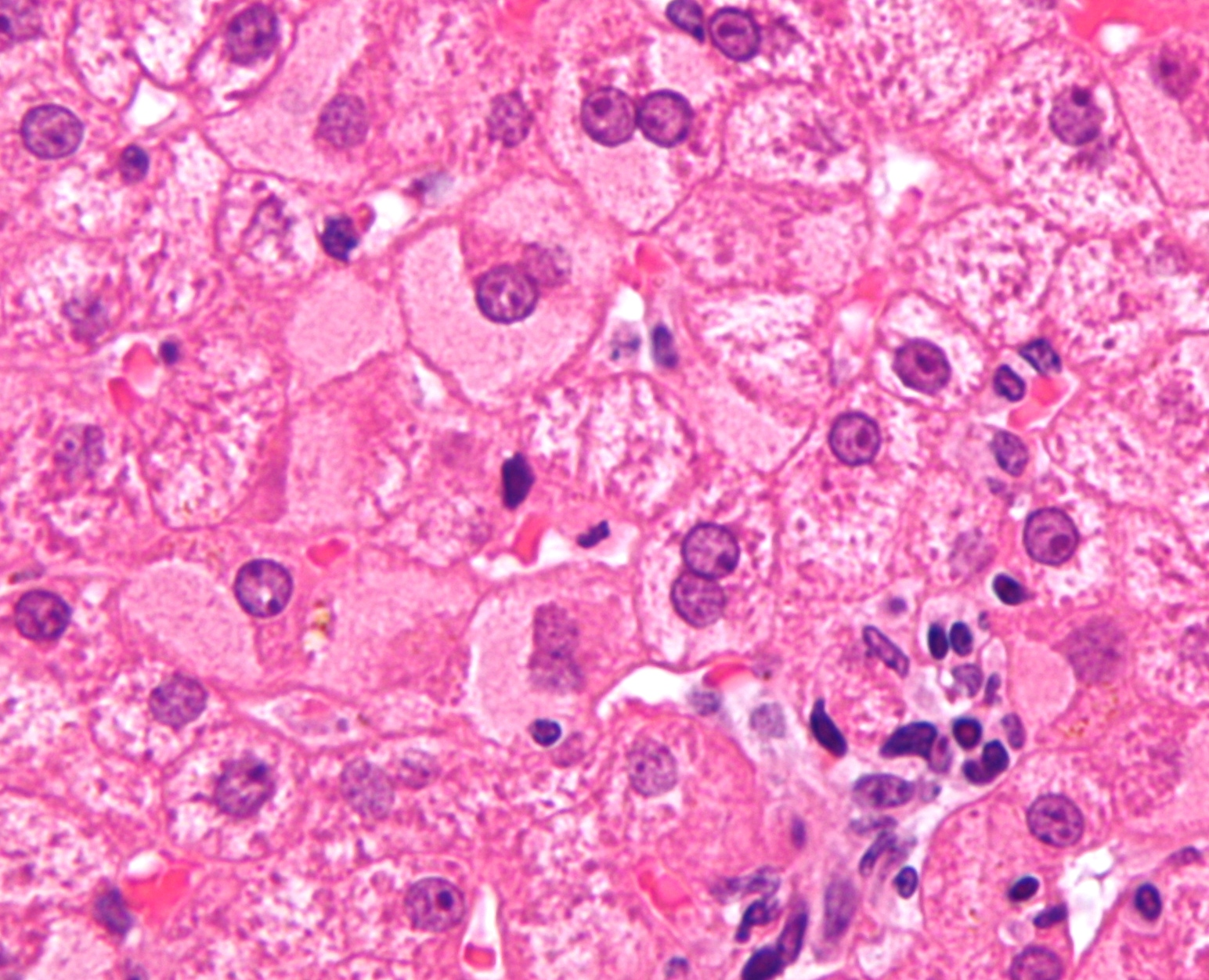 Hepatocytes (public domain)