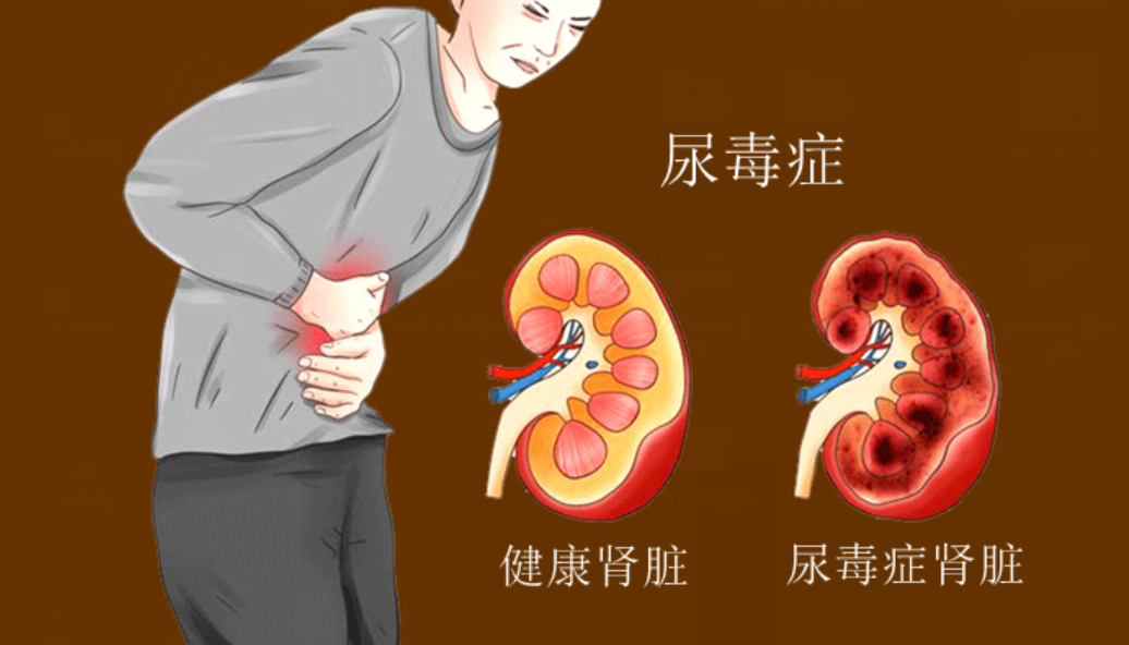 understanding-chronic-kidney-disease-symptoms-causes-and-detection