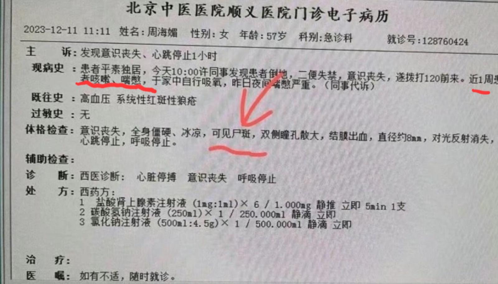周海媚 曾为中共站台周海媚病例引发质疑与新冠XBB.1.16症状相似（视频） | 周海媚去世| 周海媚病例| 红斑狼疮| 新冠病毒| XBB.1.16 |  希望之声